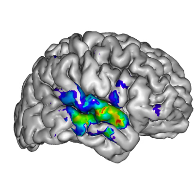 Complex brain image